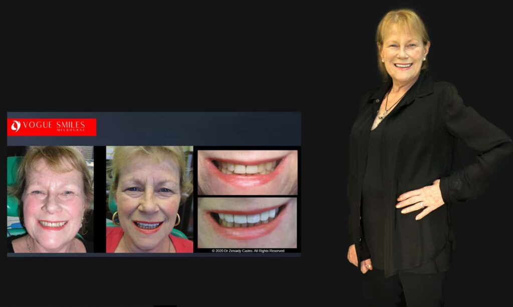 Cosmetic Dentistry near Mulgrave VIC - Cosmetic Dentist in Mulgrave VIC Australia