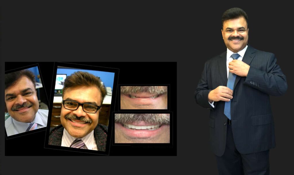 Cosmetic Dentistry near Mulgrave VIC - Cosmetic Dentist in Mulgrave VIC Australia
