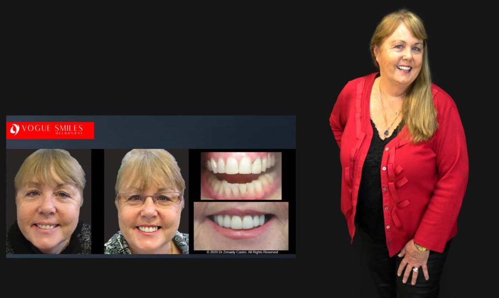 Cosmetic Dentistry near Mulgrave VIC - Cosmetic Dentist in Mulgrave VIC Australia