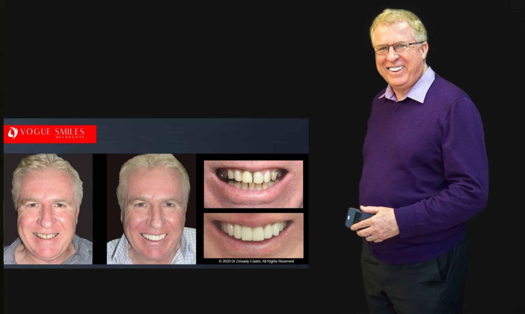 Cosmetic Dentistry near Mulgrave VIC - Cosmetic Dentist in Mulgrave VIC Australia
