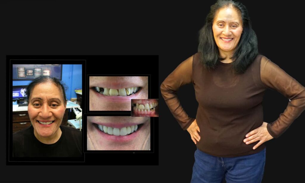 Cosmetic Dentistry near Mulgrave VIC - Cosmetic Dentist in Mulgrave VIC Australia