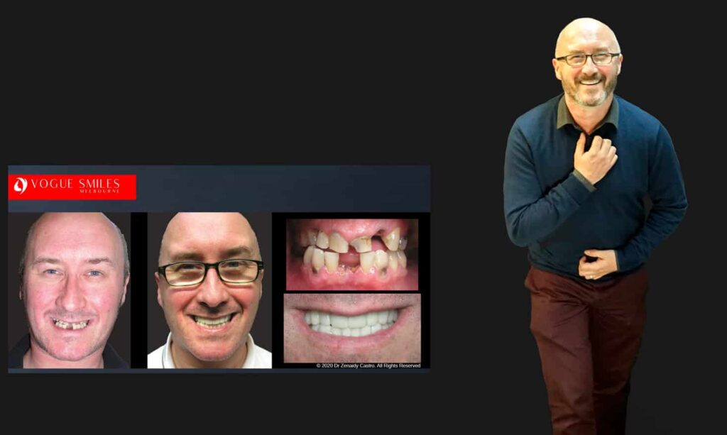 Cosmetic Dentistry near Mulgrave VIC - Cosmetic Dentist in Mulgrave VIC Australia