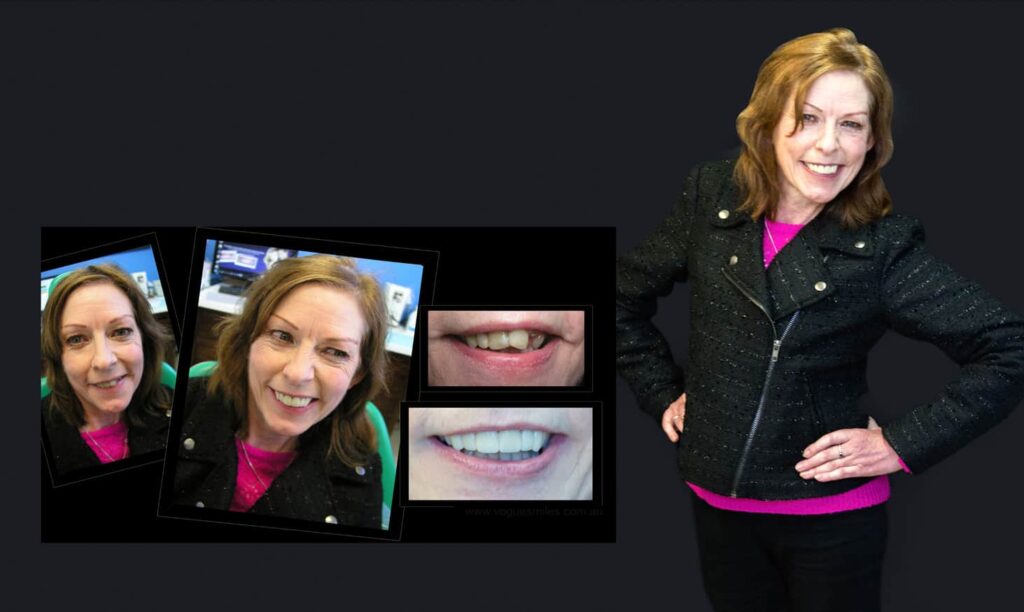Cosmetic Dentistry near Mulgrave VIC - Cosmetic Dentist in Mulgrave VIC Australia