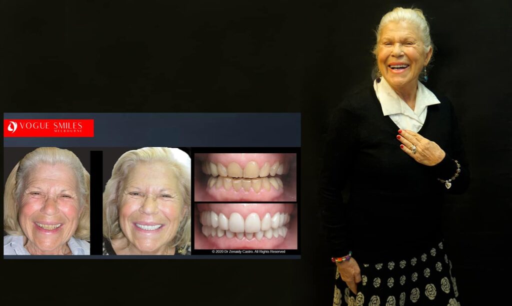 Cosmetic Dentistry near Mulgrave VIC - Cosmetic Dentist in Mulgrave VIC Australia