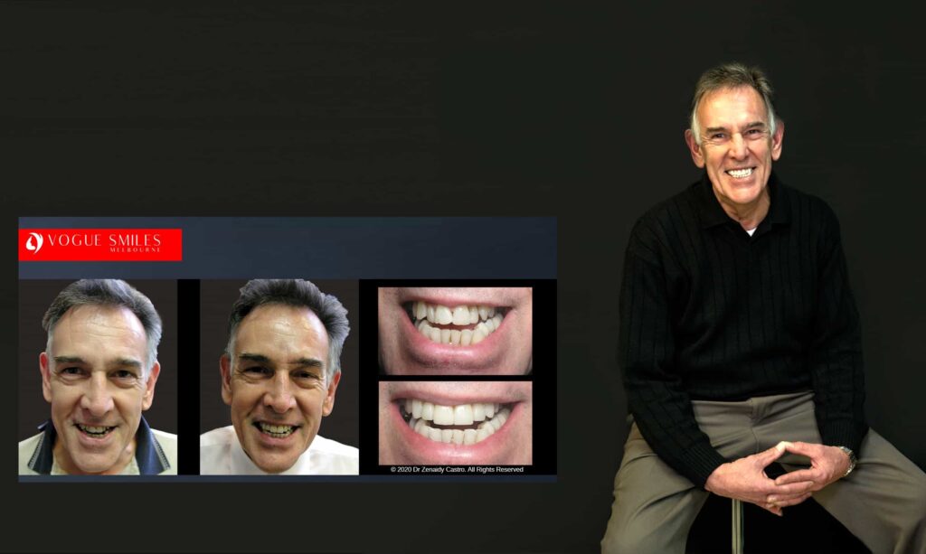Cosmetic Dentistry near Mulgrave VIC - Cosmetic Dentist in Mulgrave VIC Australia
