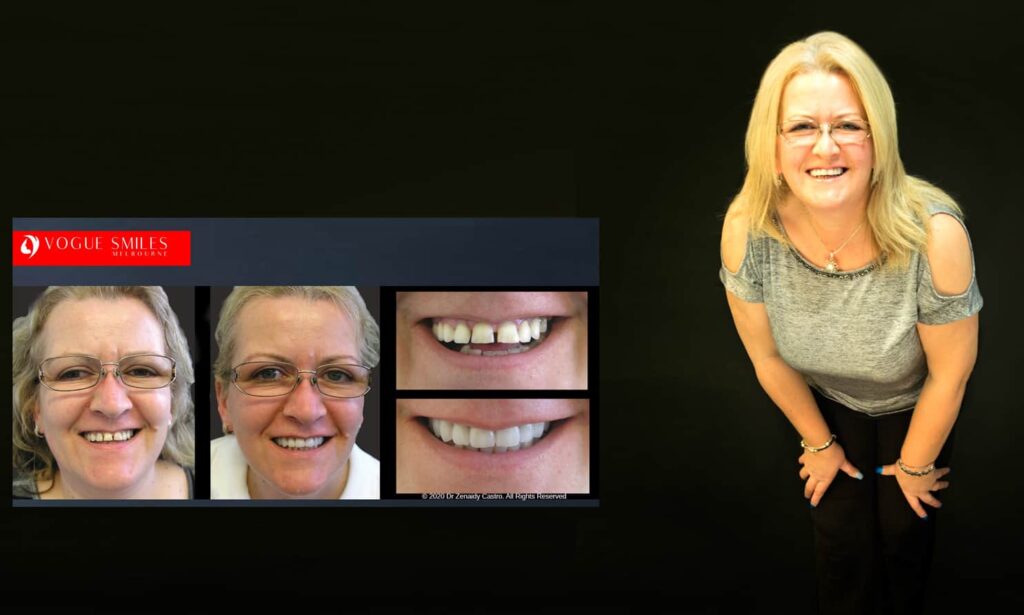 Cosmetic Dentistry near Mulgrave VIC - Cosmetic Dentist in Mulgrave VIC Australia