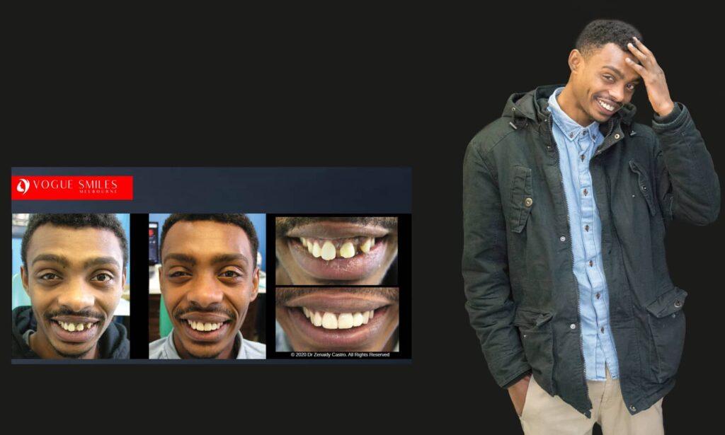Cosmetic Dentistry near Mulgrave VIC - Cosmetic Dentist in Mulgrave VIC Australia