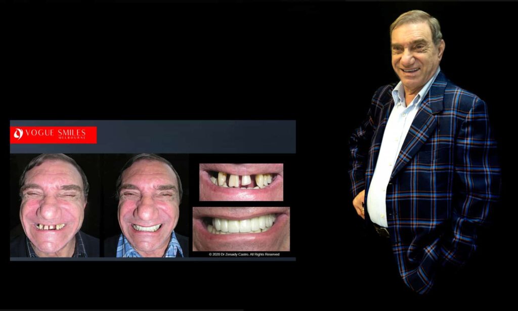 Cosmetic Dentistry near Mulgrave VIC - Cosmetic Dentist in Mulgrave VIC Australia