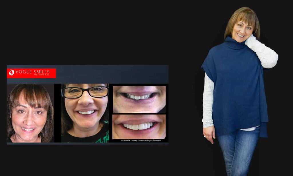 Cosmetic Dentistry near Mulgrave VIC - Cosmetic Dentist in Mulgrave VIC Australia