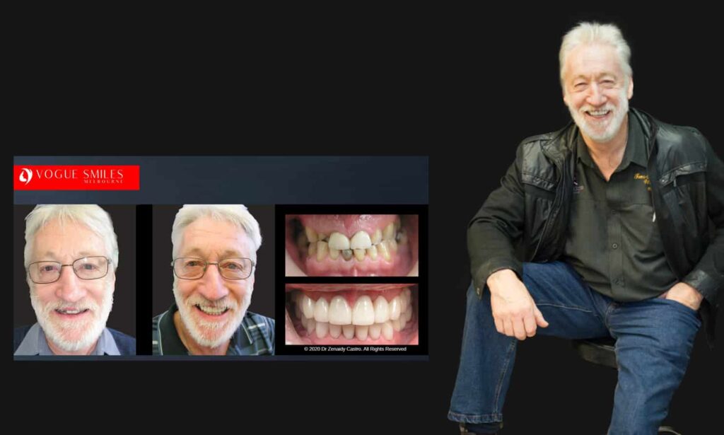 Cosmetic Dentistry near Mulgrave VIC - Cosmetic Dentist in Mulgrave VIC Australia