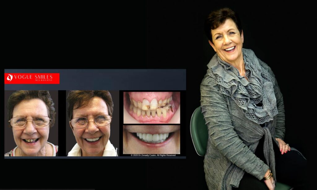 Cosmetic Dentistry near Mulgrave VIC - Cosmetic Dentist in Mulgrave VIC Australia