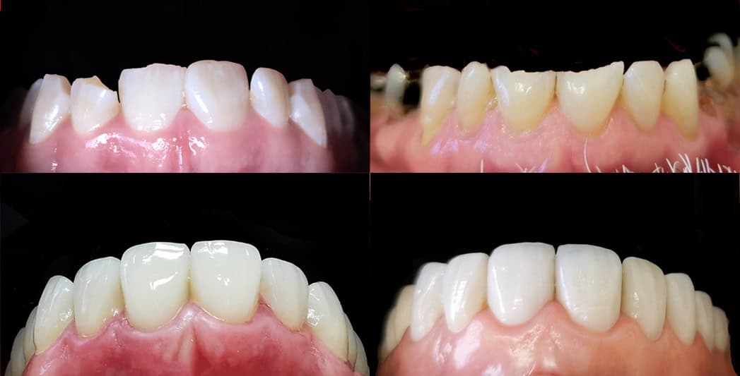 Best Cosmetic Dentistry Procedures in Noble Park North, GLEN WAVERLEY, MULGRAVE, JACKSON ROAD, DANDENONG, SPRINGVALE