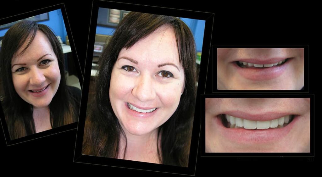 How to Finance Your Smile Makeover Without Breaking the Bank