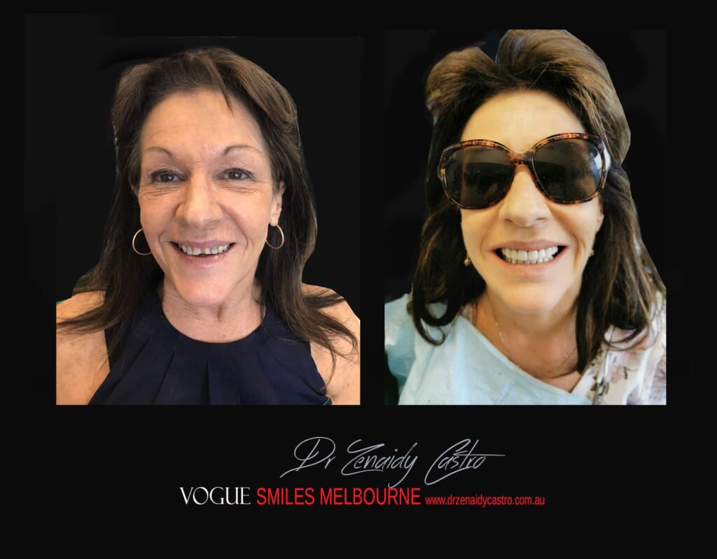 VOGUE-SMILES-COSMETIC-DENTISTRY