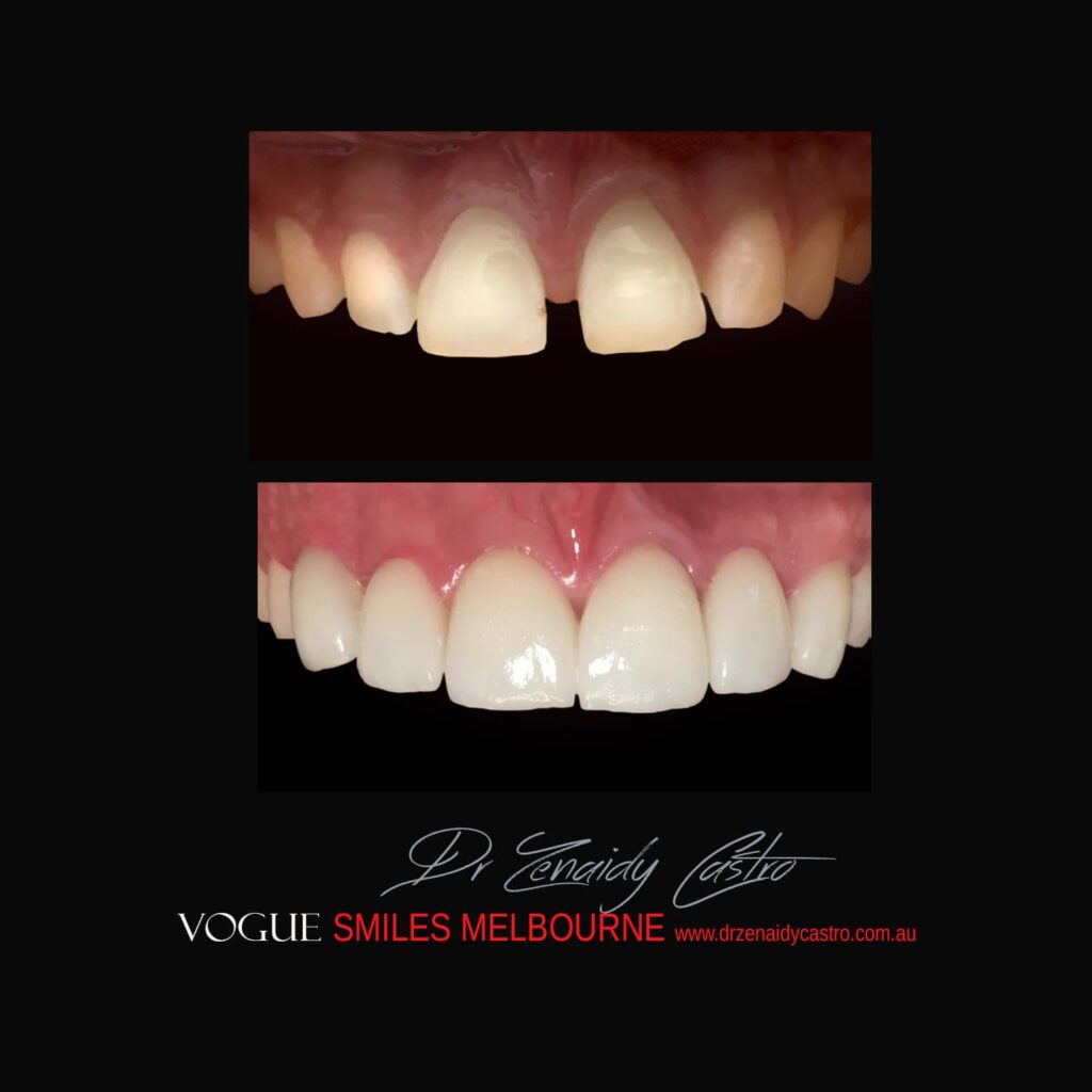 VOGUE-SMILES-COSMETIC-DENTISTRY-TREATMENT