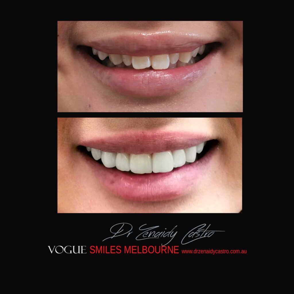 VOGUE-SMILES-COSMETIC-DENTISTRY-TREATMENT