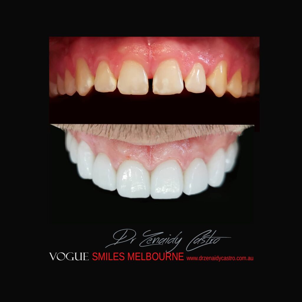 VOGUE-SMILES-COSMETIC-DENTISTRY-TREATMENT