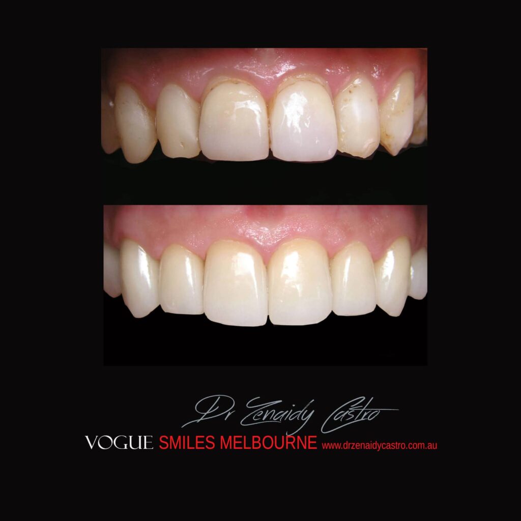 VOGUE-SMILES-COSMETIC-DENTISTRY-TREATMENT