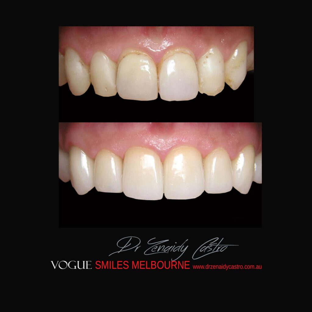 VOGUE-SMILES-COSMETIC-DENTISTRY-TREATMENT