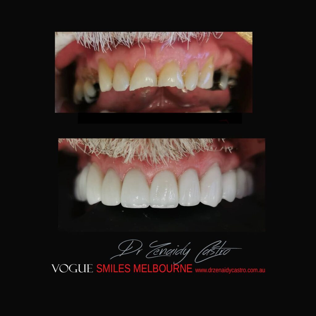 VOGUE-SMILES-COSMETIC-DENTISTRY-TREATMENT