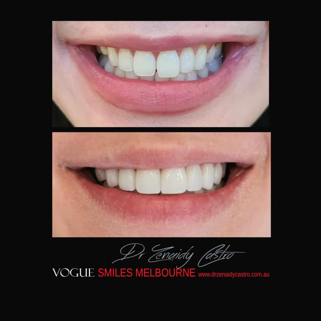 VOGUE-SMILES-COSMETIC-DENTISTRY-TREATMENT