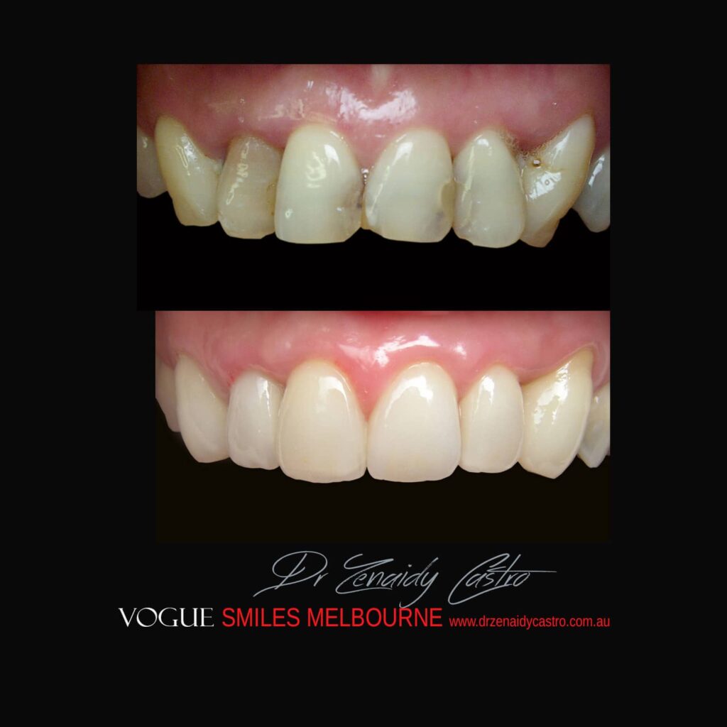 VOGUE-SMILES-COSMETIC-DENTISTRY-TREATMENT