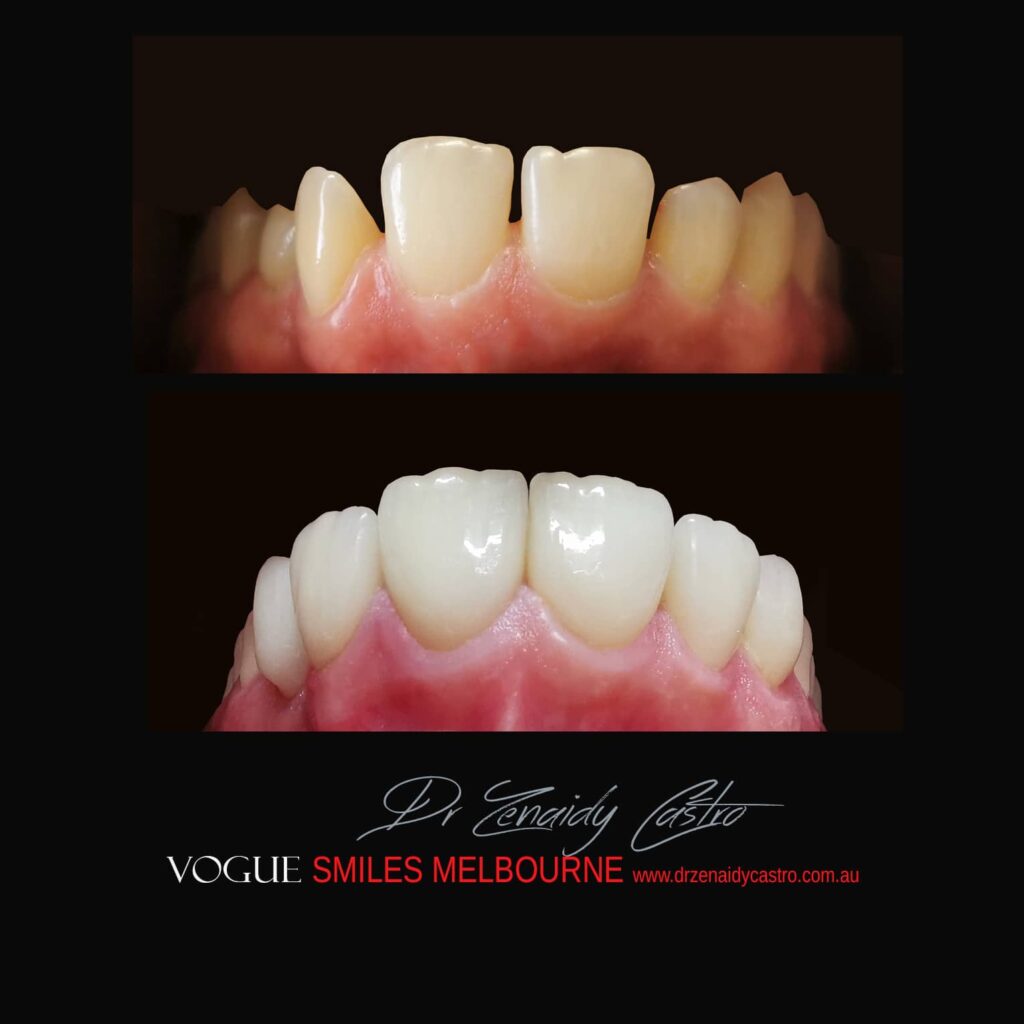VOGUE-SMILES-COSMETIC-DENTISTRY-TREATMENT