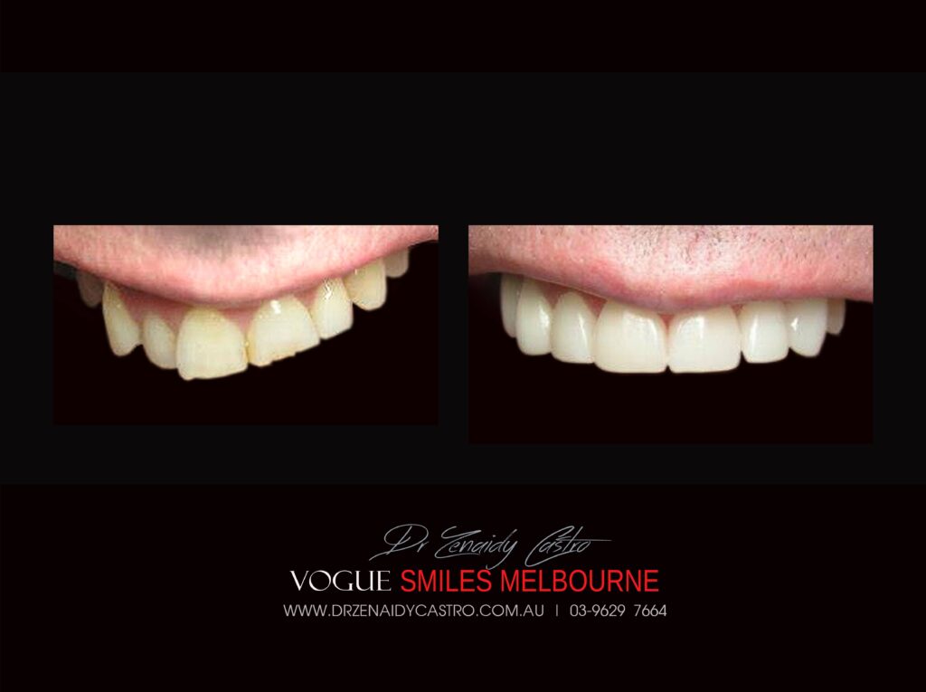 VOGUE-SMILES-COSMETIC-DENTISTRY-TREATMENT