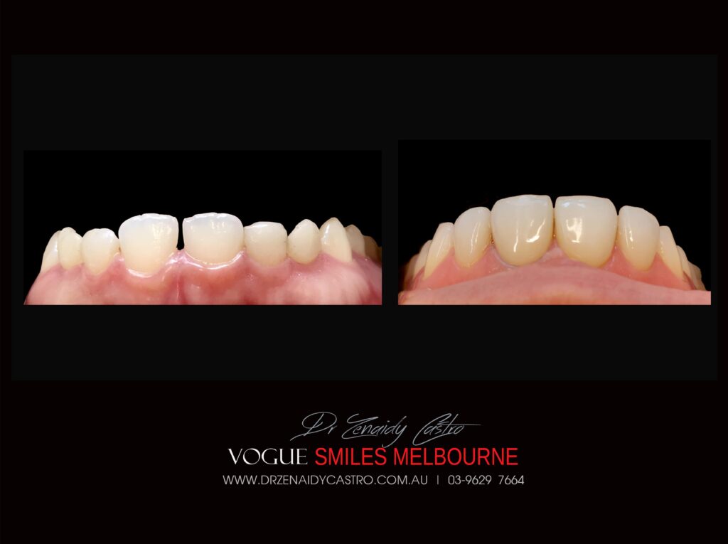 VOGUE-SMILES-COSMETIC-DENTISTRY-TREATMENT