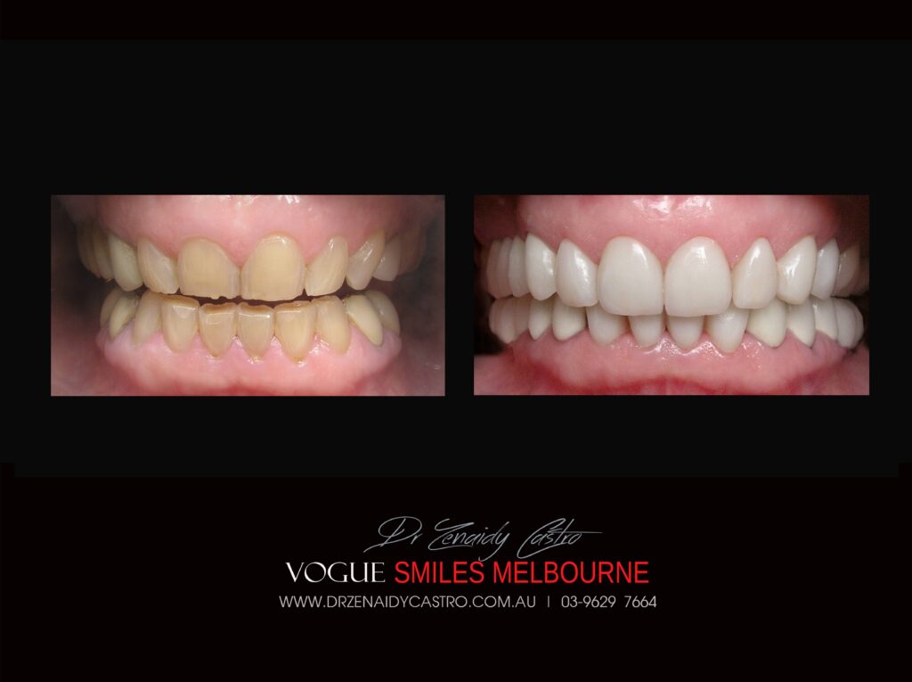 VOGUE-SMILES-COSMETIC-DENTISTRY-TREATMENT