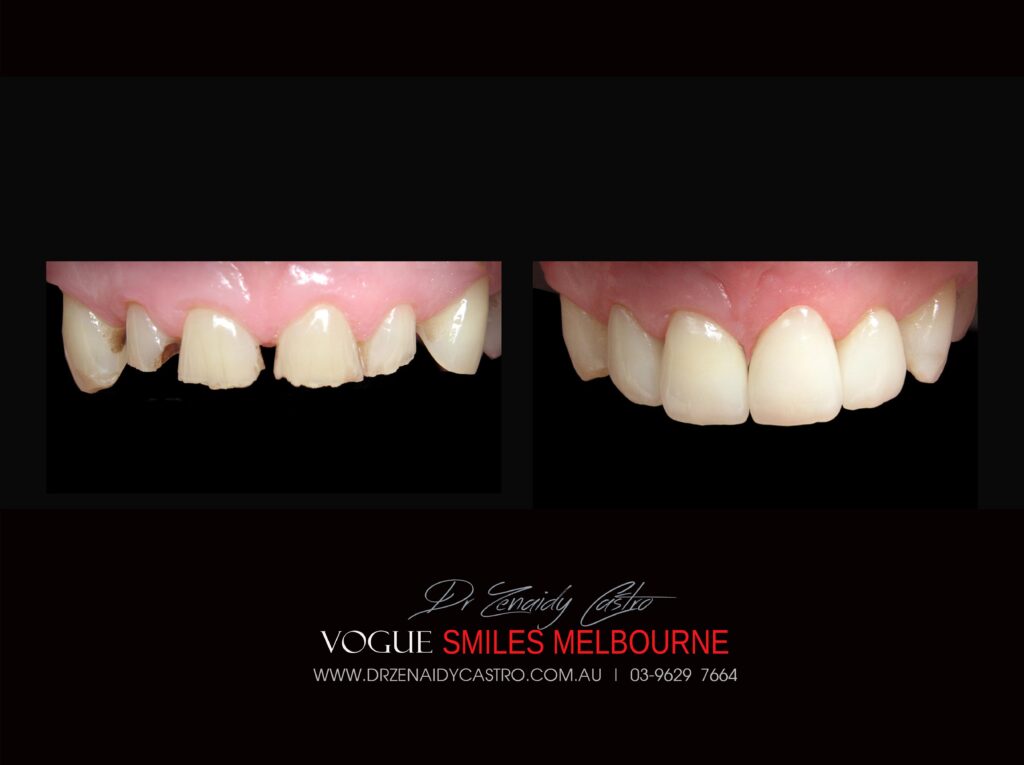 VOGUE-SMILES-COSMETIC-DENTISTRY-TREATMENT