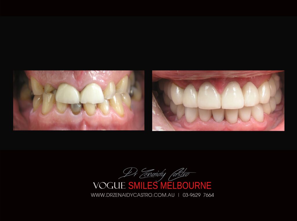 VOGUE-SMILES-COSMETIC-DENTISTRY-TREATMENT