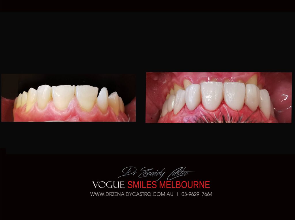 VOGUE-SMILES-COSMETIC-DENTISTRY-TREATMENT