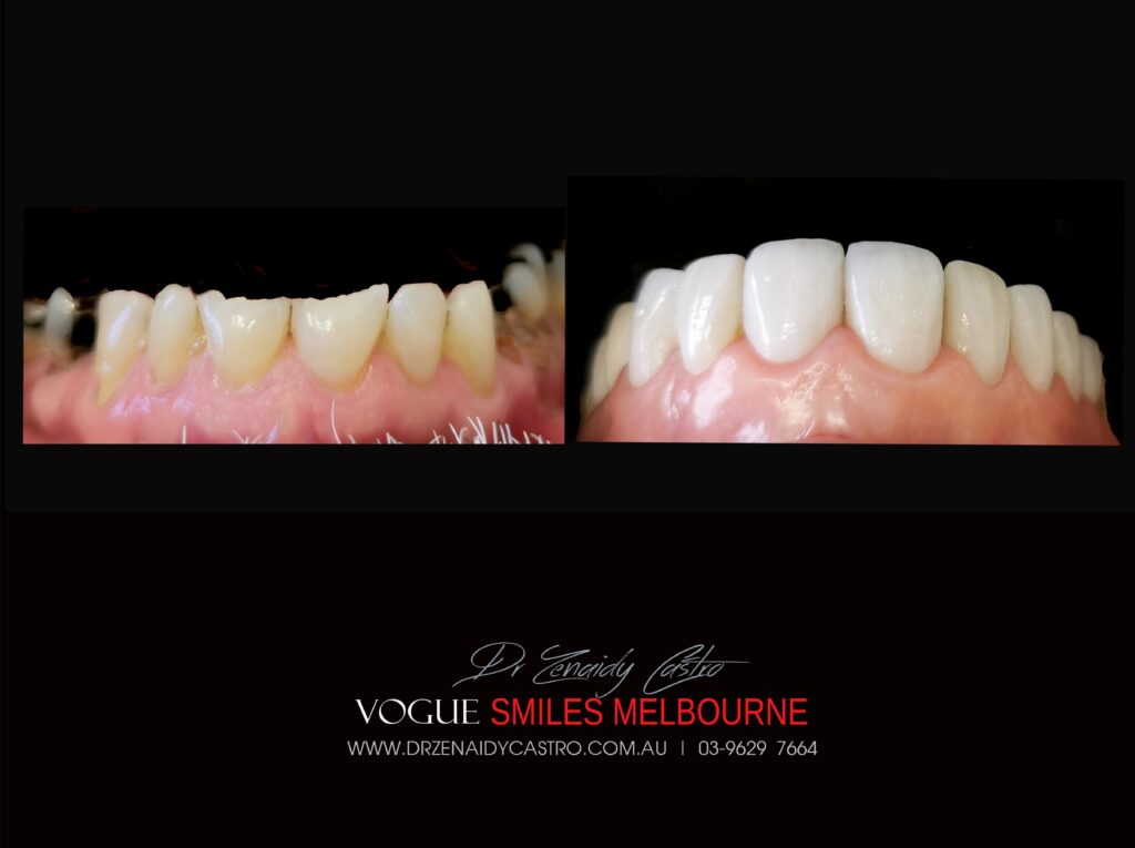 VOGUE-SMILES-COSMETIC-DENTISTRY-TREATMENT