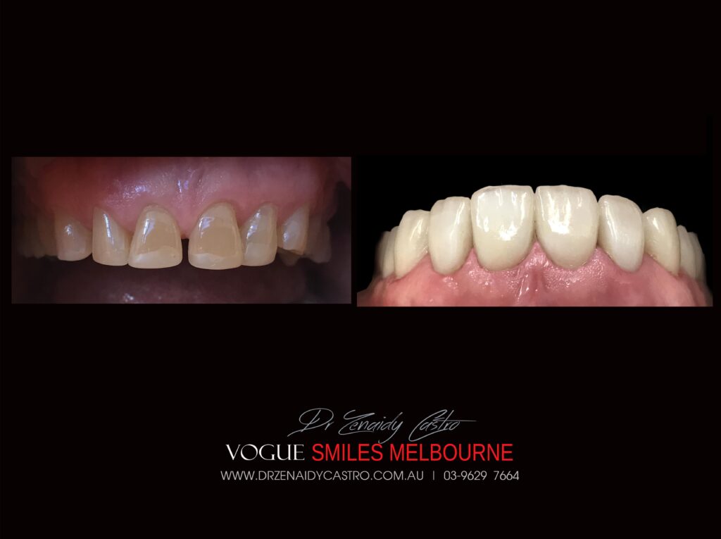 VOGUE-SMILES-COSMETIC-DENTISTRY-TREATMENT