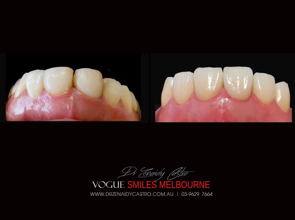VOGUE-SMILES-COSMETIC-DENTISTRY-TREATMENT