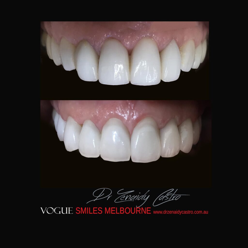 VOGUE-SMILES-COSMETIC-DENTISTRY-TREATMENT