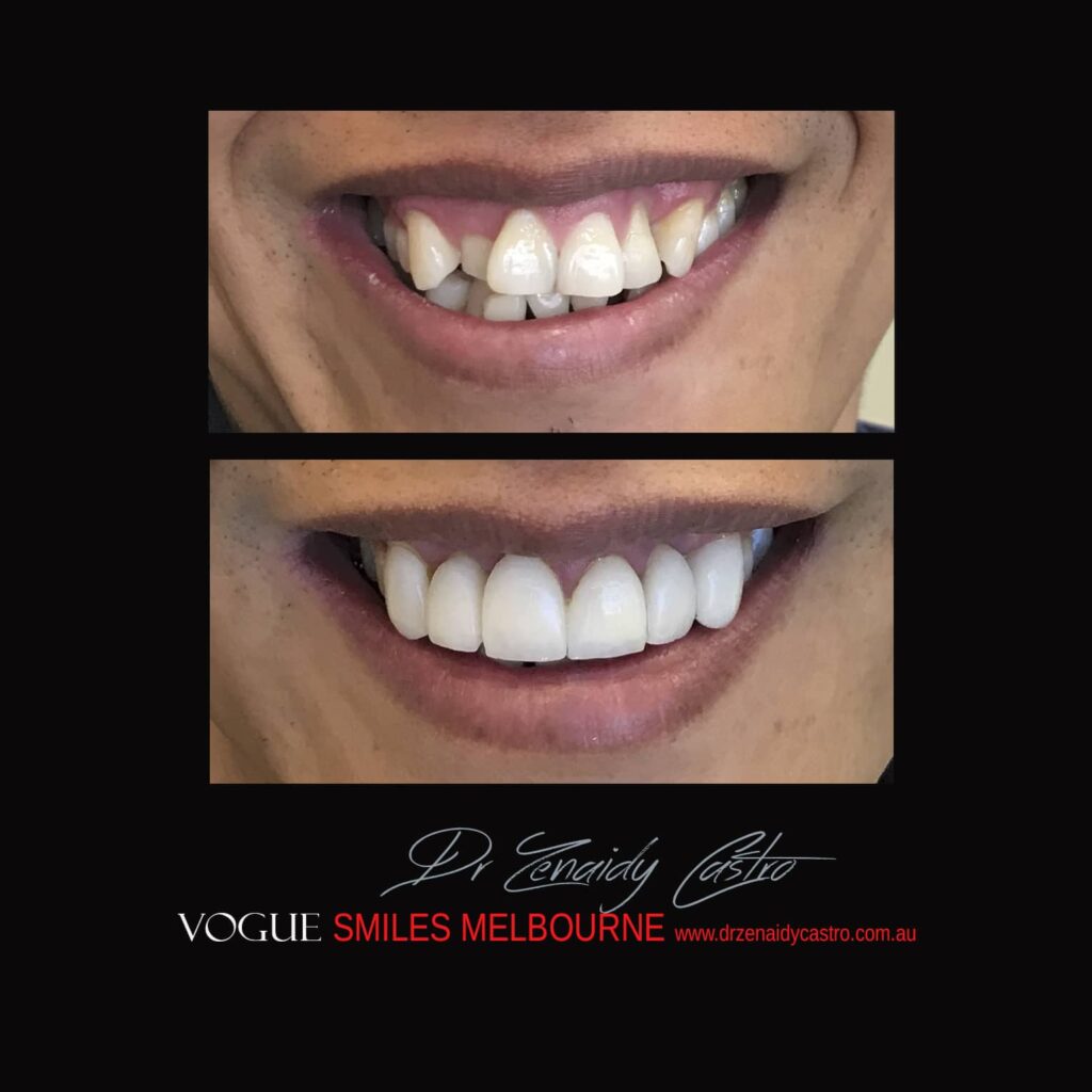 VOGUE-SMILES-COSMETIC-DENTISTRY-TREATMENT
