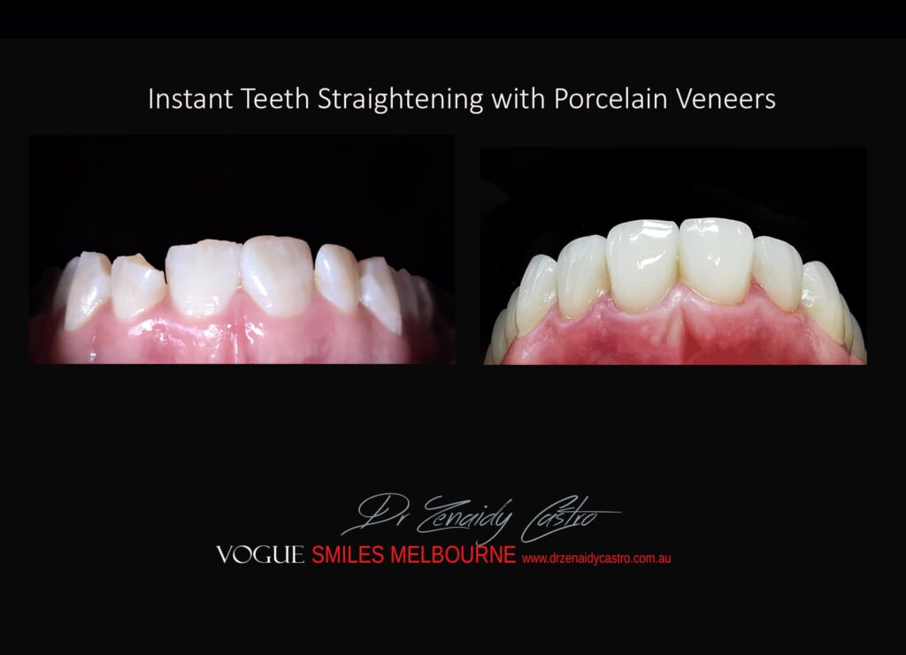 VOGUE-SMILES-COSMETIC-DENTISTRY-TREATMENT