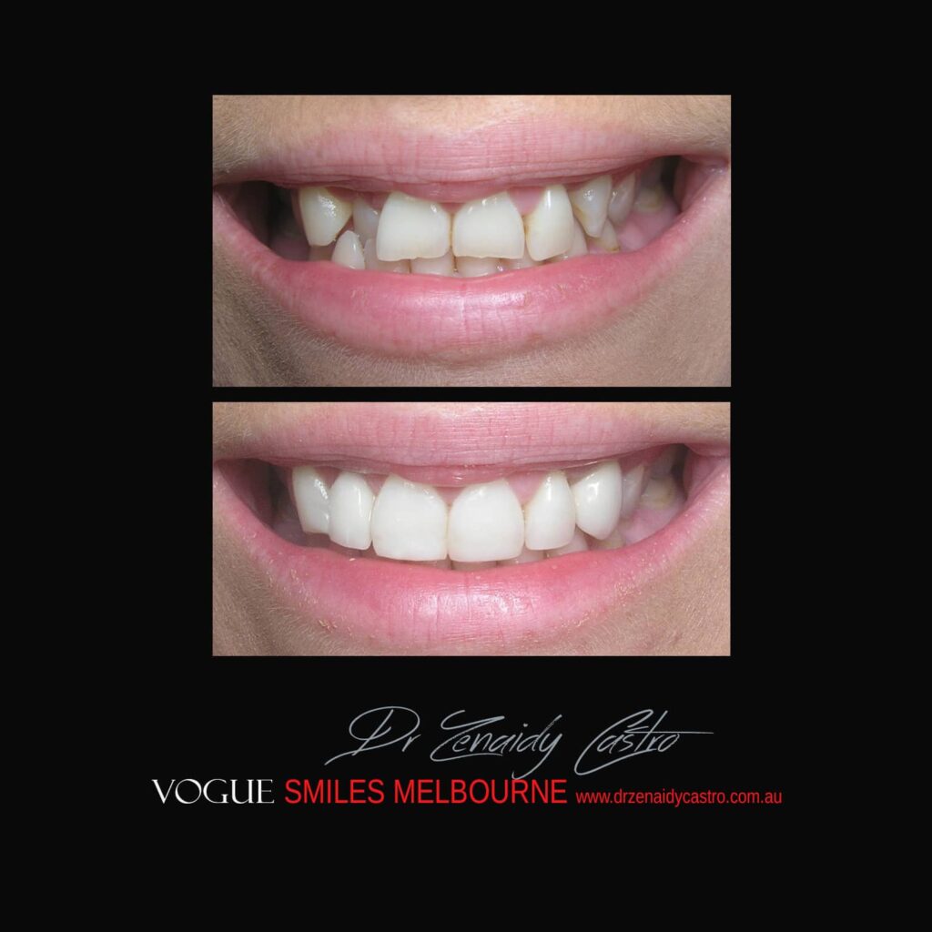 VOGUE-SMILES-COSMETIC-DENTISTRY-TREATMENT