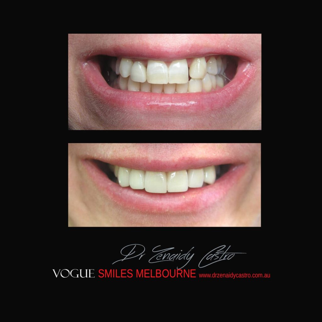 VOGUE-SMILES-COSMETIC-DENTISTRY-TREATMENT
