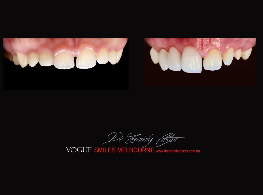 VOGUE-SMILES-COSMETIC-DENTISTRY-TREATMENT