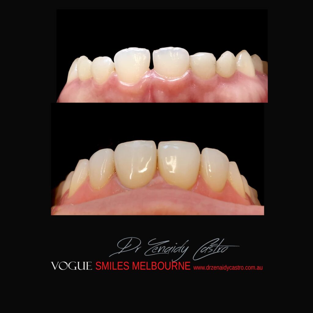 VOGUE-SMILES-COSMETIC-DENTISTRY-TREATMENT