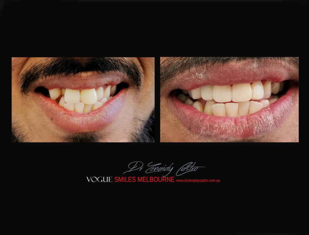 VOGUE-SMILES-COSMETIC-DENTISTRY-TREATMENT