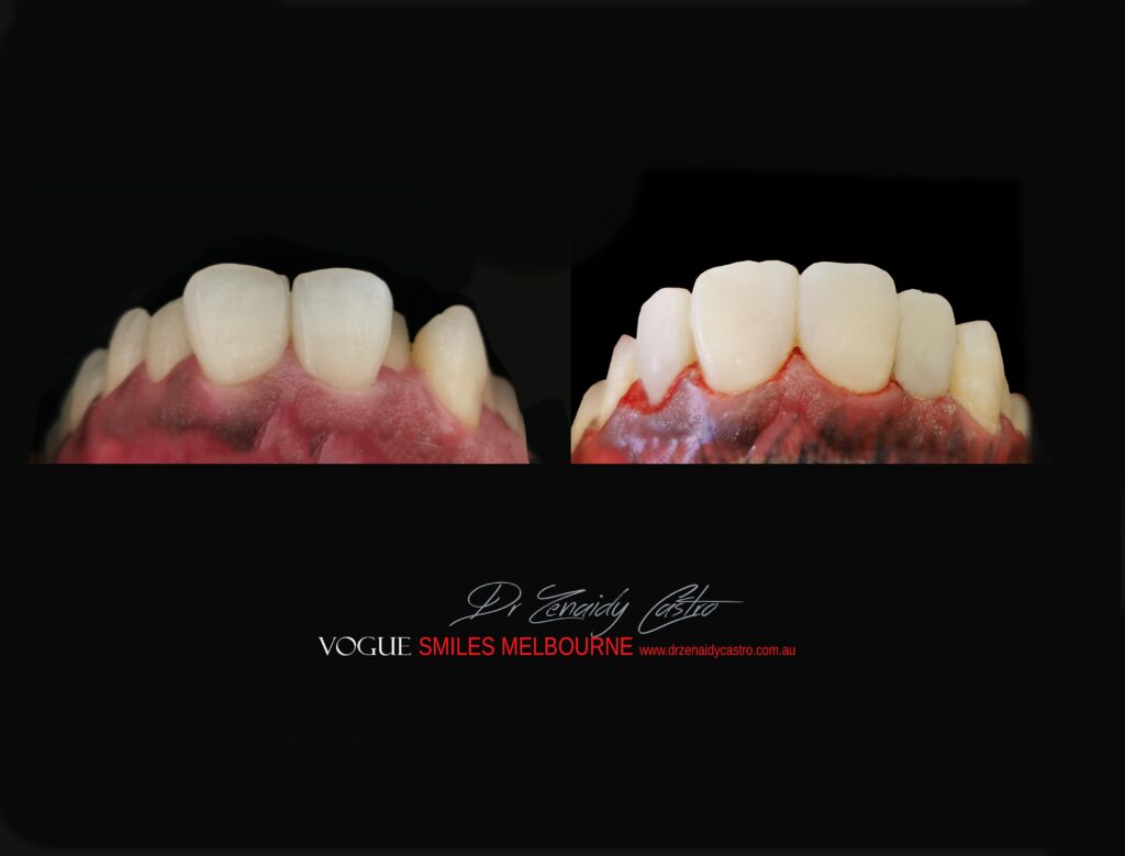 VOGUE-SMILES-COSMETIC-DENTISTRY-TREATMENT
