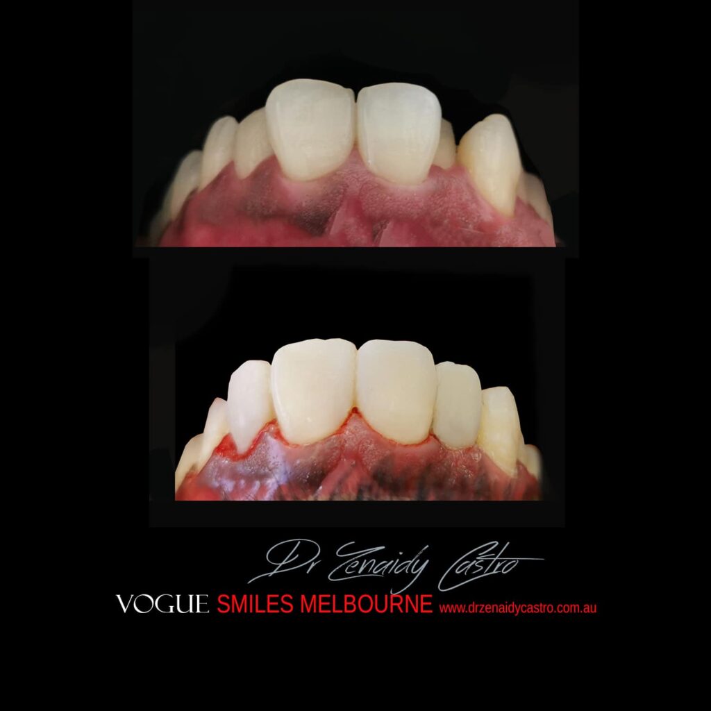 VOGUE-SMILES-COSMETIC-DENTISTRY-TREATMENT