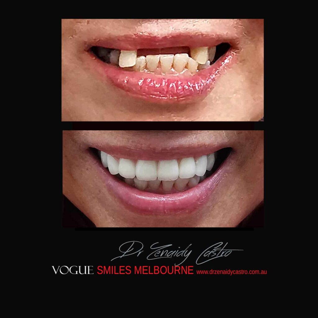 VOGUE-SMILES-COSMETIC-DENTISTRY-TREATMENT