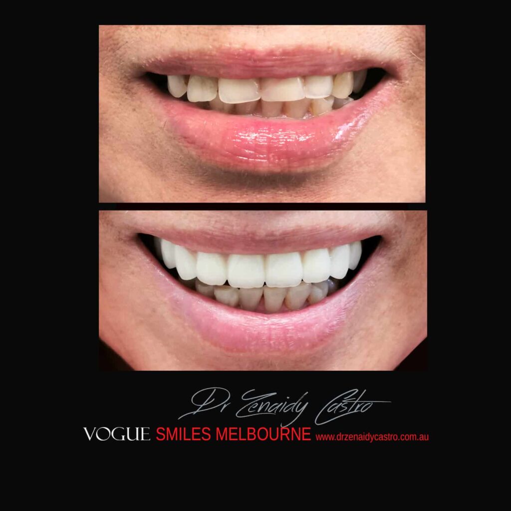 VOGUE-SMILES-COSMETIC-DENTISTRY-TREATMENT