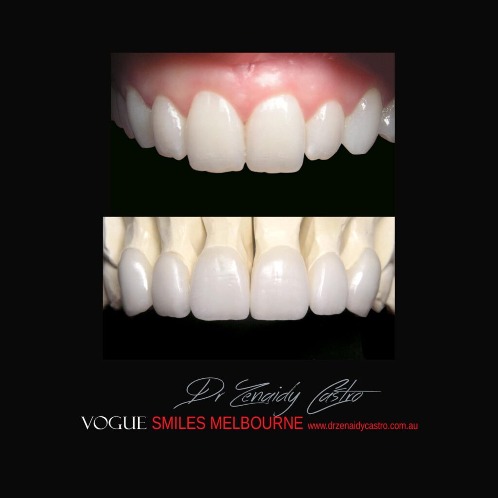 VOGUE-SMILES-COSMETIC-DENTISTRY-TREATMENT