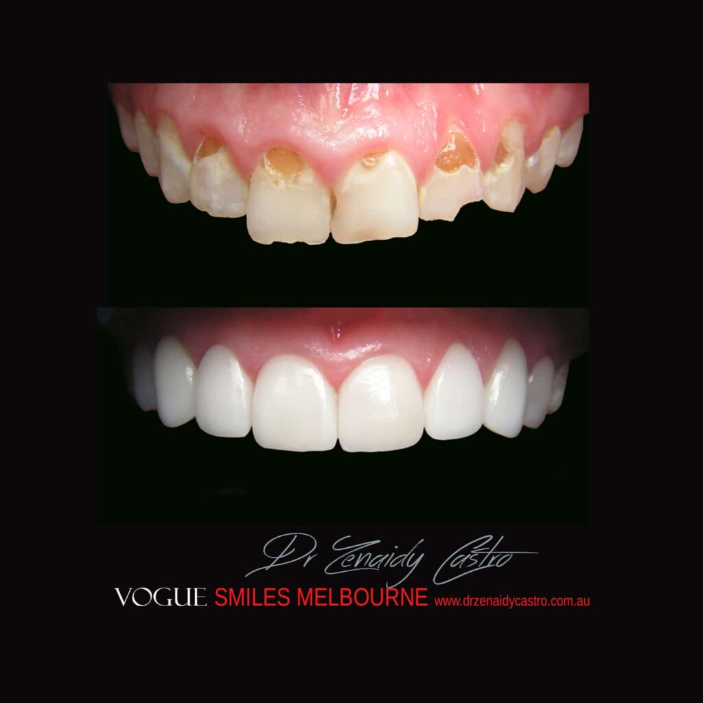 VOGUE-SMILES-COSMETIC-DENTISTRY-TREATMENT